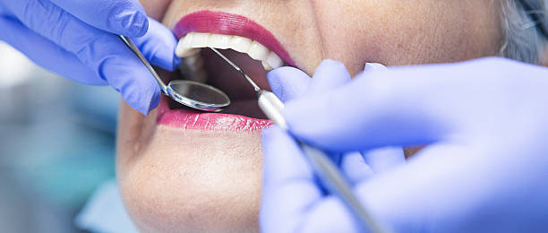 Best Emergency Root Canal Therapy in Westmont, CA