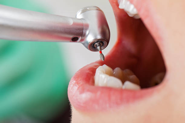 Best Walk-In Emergency Dental Services in Westmont, CA